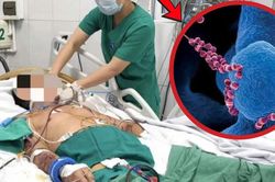 Người đàn ông 61 tuổi suy đa tạng, xuất huyết hoại tử vì thói quen phổ biến