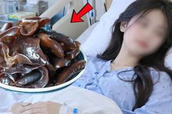 Ăn mộc nhĩ theo cách này, nữ tiến sĩ 35 tuổi tử vong vì ung thư gan