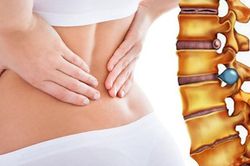 Thoát vị đĩa đệm khi nào cần phẫu thuật?