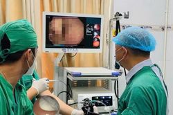 Uống nước, người đàn ông 51 tuổi nuốt luôn hàm răng giả dài 6 cm