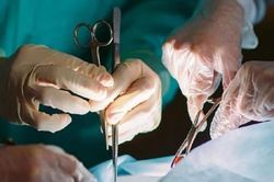 Người đàn ông cắt bỏ dạ dày trị ung thư, mổ xong mới biết mình không mắc bệnh