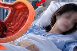 Người phụ nữ phát hiện ung thư dạ dày giai đoạn cuối từ dấu hiệu ợ