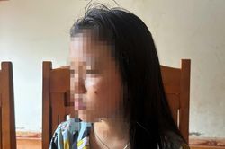 Vụ nữ sinh lớp 10 bị đánh, dí thuốc vào mặt ở Đắk Lắk: Nạn nhân không dám đi học