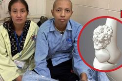 Cậu bé 16 tuổi mồ côi cha từ nhỏ phải cắt một phần chân vì ung thư