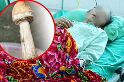 4 người trong một gia đình nhập viện sau bữa cơm có nấm lạ