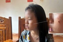 Nữ sinh lớp 10 ở Đắk Lắk lên tiếng về nguyên nhân bị bạn hành hung