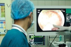 PGS Nguyễn Lân Hiếu chỉ ra 3 lý do người Việt hay được chẩn đoán viêm dạ dày