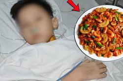 Ăn tôm đồng, bé trai 14 tuổi mẩn đỏ toàn thân nhập viện nguy kịch