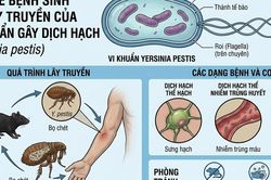 Dịch hạch nguy hiểm thế nào, tại sao chưa tiêm vaccine đại trà?