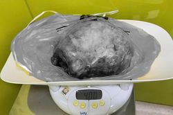 Bé trai chào đời an toàn dù mẹ mang khối u xơ tử cung 4kg