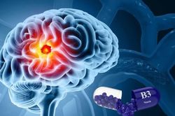 Phát hiện Vitamin B3 có tác dụng tích cực trong điều trị ung thư não
