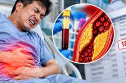 Đau bụng dữ dội, nhập viện phát hiện chỉ số mỡ máu cao gấp gần 20 lần