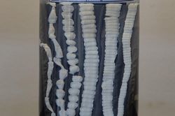 Món khoái khẩu khiến người phụ nữ có sán dài hơn 70 cm mà không biết
