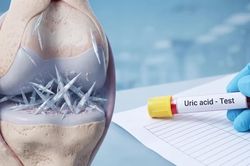 Axit uric cao tàn phá ngầm cơ thể thế nào dù không đau nhức?