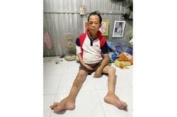 Hoàn cảnh anh Lê Hòa Bình rất cần sự chia sẻ từ cộng đồng