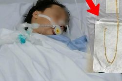 Người phụ nữ 48 tuổi phát hiện sán dây bò dài 70cm dù không có triệu chứng