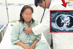 Đột ngột khó thở, cô gái 27 tuổi nhập viện phát hiện u quái trung thất