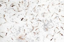 Cảnh báo nguy cơ sốt rét ở người từng làm việc tại châu Phi
