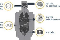 Đo huyết áp tại nhà - những điều cần lưu ý