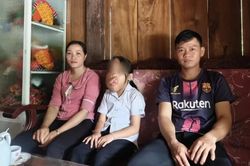 Đắk Lắk: Cô học trò có khối u trên mặt được phẫu thuật miễn phí