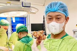 Phẫu thuật lấy khối sỏi san hô 'khủng' sau 20 năm âm thầm hình thành