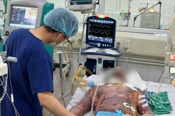 4 người nhập viện vì liên cầu lợn, có bệnh nhân nguy kịch