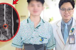Nam sinh mới 17 tuổi đã suýt liệt vì thoát vị đĩa đệm