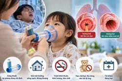Chuyên gia cảnh báo nguy hiểm khi tự ý ngừng thuốc điều trị hen cho trẻ