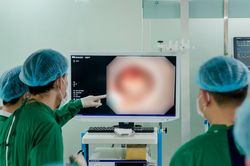 Đau đầu ch&oacute;ng mặt tưởng tiền đ&igrave;nh, b&agrave;ng ho&agrave;ng ph&aacute;t hiện ung thư phổi di căn n&atilde;o
