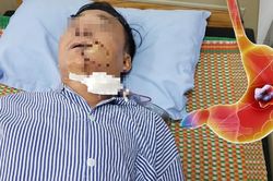 Người đàn ông 50 tuổi bàng hoàng phát hiện ung thư sau thời gian dài hôi miệng