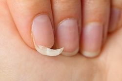 Những biểu hiện bất thường cảnh b&aacute;o suy gi&aacute;p
