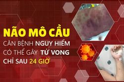 TPHCM: Ghi nhận ca bệnh do n&atilde;o m&ocirc; cầu tại x&atilde; Thường T&acirc;n