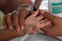 Chủ động ứng ph&oacute; trước diễn biến dịch bệnh c&oacute; xu hướng gia tăng theo m&ugrave;a