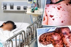 TPHCM ghi nhận ca n&atilde;o m&ocirc; cầu mới tại x&atilde; Thường T&acirc;n
