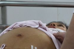 Ngứa ran khắp người nghĩ dị ứng hải sản, h&oacute;a ra ung thư gan giai đoạn cuối