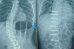 Ca phẫu thuật lần đầu tiên có ở Việt Nam