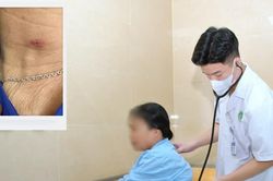Sốt cao, đắp 3 chăn vẫn r&eacute;t: Ph&aacute;t hiện sốt m&ograve; từ vết lo&eacute;t nhỏ