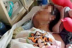 Nữ sinh tái phát tổn thương não sau tai nạn