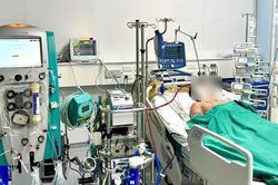 Sốt xuất huyết quật ng&atilde; nam thanh ni&ecirc;n 23 tuổi, phải d&ugrave;ng ECMO gi&agrave;nh giật sự sống