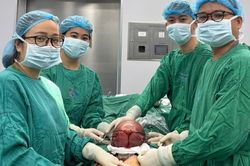 Nữ điều dưỡng hiến m&aacute;u cứu người phụ nữ c&oacute; khối u tử cung 13cm