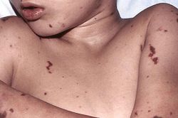 Hiểu đ&uacute;ng về n&atilde;o m&ocirc; cầu để kh&ocirc;ng bỏ lỡ thời điểm v&agrave;ng