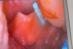 Hiểm họa từ những viên nam châm trong đồ chơi xếp hình của trẻ