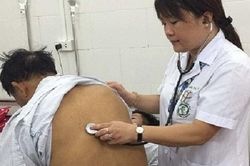 Nhiễm sán lá gan, giun lươn vì mê ăn gỏi, rau sống