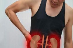 Điều trị sỏi thận tại nhà hiệu quả