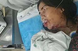 Sự thật bất ngờ về thông tin cô dâu Việt bị chồng bạo hành đến nhập viện