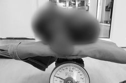 Bụng chướng to như cái trống, hóa ra có khối u nặng gần 4kg