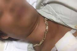 Vụ côn đồ cầm dao xông vào nhà chém người dân: Đến bệnh viện để truy sát