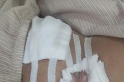 Được đặc cách, nữ thí sinh vừa mổ ruột thừa vẫn quyết tâm dự thi THPT Quốc gia