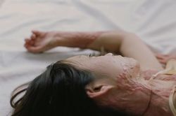 Xót xa với loạt ảnh cơ thể chằng chịt sẹo của nữ sinh bị nam sinh cùng lớp phá hủy dung nhan chỉ vì… cuồng yêu