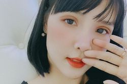 Bất ngờ nhan sắc khác lạ của Kỳ Hân sau dao kéo